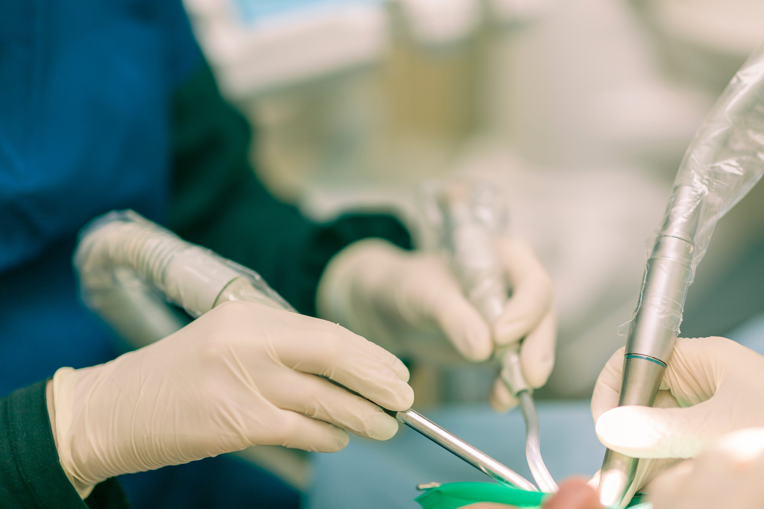 root canal 