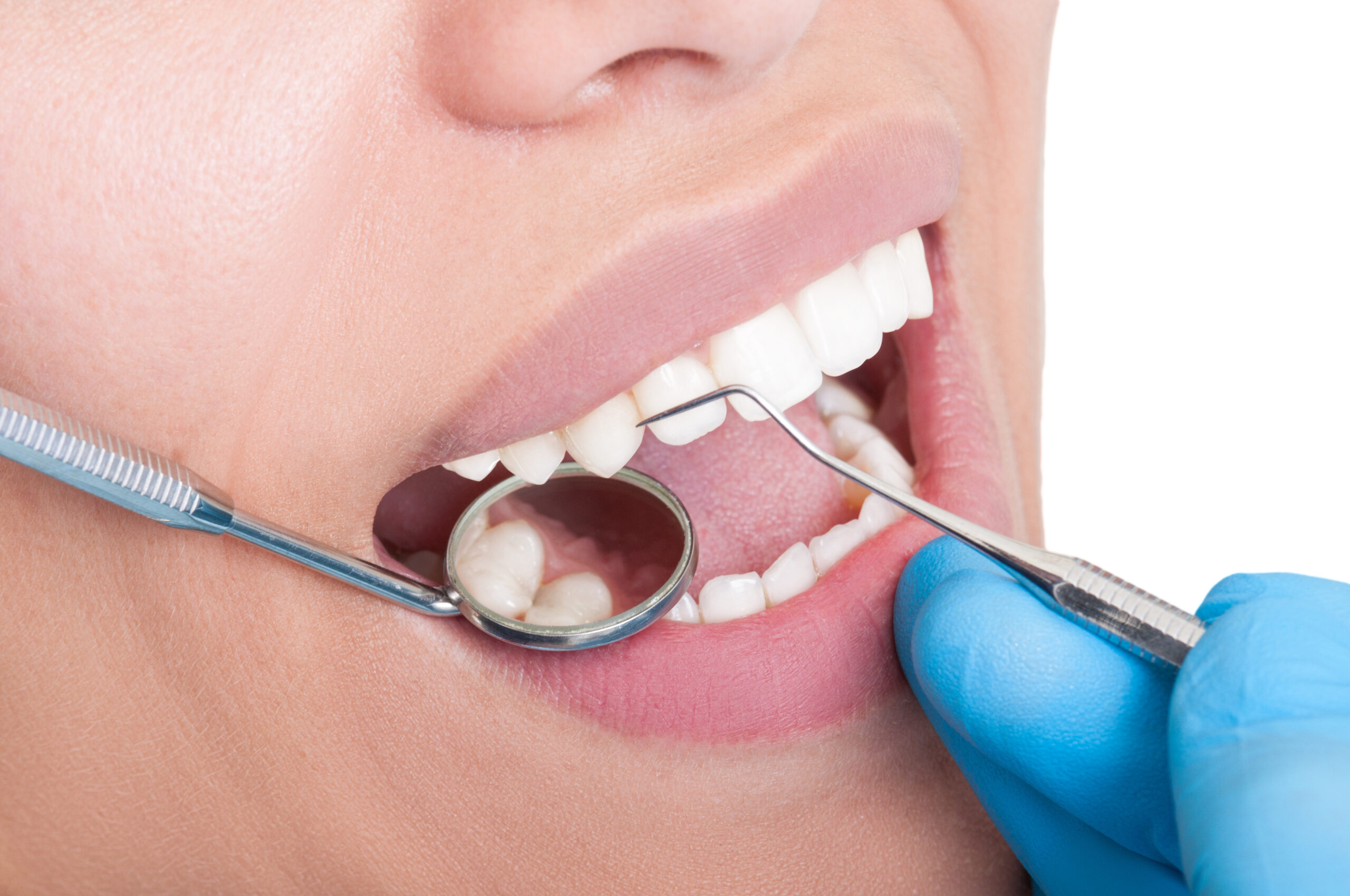 cavity detection